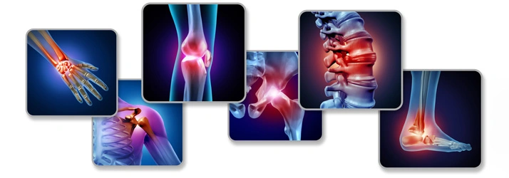 Banner showing multiple medical-style illustrations highlighting joints and spine areas against dark backgrounds.